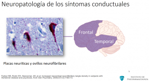 neurobiologia de los sintomas conductuales